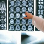 Healthcare professional pointing at a series of detailed MRI brain scans on a light board, illustrating a key part of a career as a radiologic technologist.